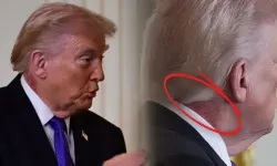 Trump'ın boynundaki morluklar gündem oldu!